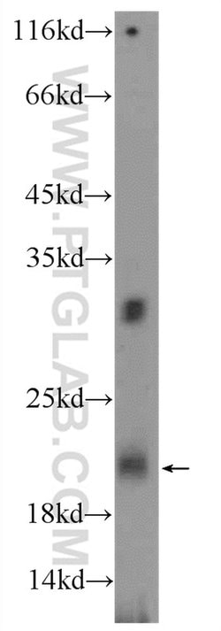 TRAPPC2L Rabbit anti-Human, Mouse, Polyclonal, Proteintech:Antibodies:Primary