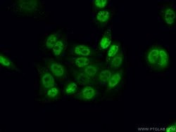 CWC15 Rabbit anti-Human, Mouse, Polyclonal, Proteintech:Antibodies:Primary