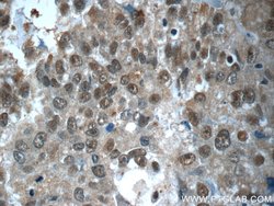 CWC15 Rabbit anti-Human, Mouse, Polyclonal, Proteintech:Antibodies:Primary