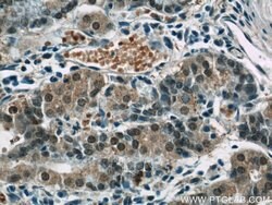 CWC15 Rabbit anti-Human, Mouse, Polyclonal, Proteintech:Antibodies:Primary