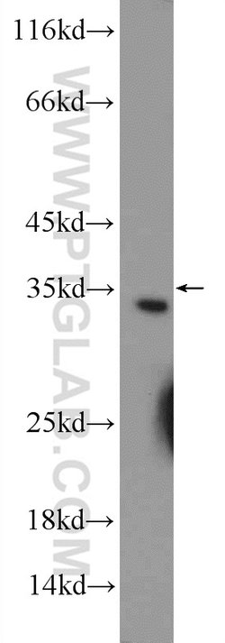 CWC15 Rabbit anti-Human, Mouse, Polyclonal, Proteintech:Antibodies:Primary