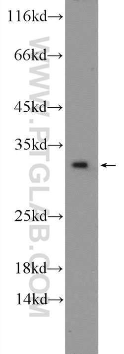 CWC15 Rabbit anti-Human, Mouse, Polyclonal, Proteintech:Antibodies:Primary
