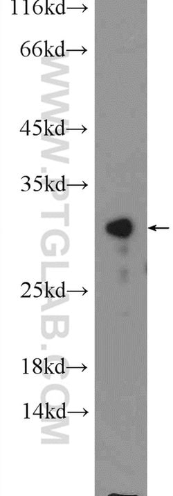 CWC15 Rabbit anti-Human, Mouse, Polyclonal, Proteintech:Antibodies:Primary