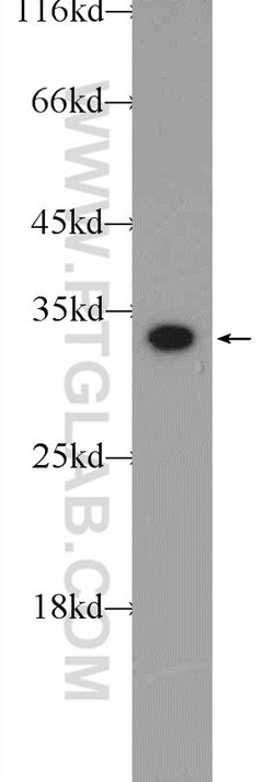 CWC15 Rabbit anti-Human, Mouse, Polyclonal, Proteintech:Antibodies:Primary