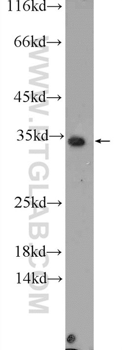 CWC15 Rabbit anti-Human, Mouse, Polyclonal, Proteintech:Antibodies:Primary