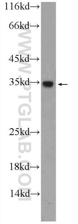 CWC15 Rabbit anti-Human, Mouse, Polyclonal, Proteintech:Antibodies:Primary