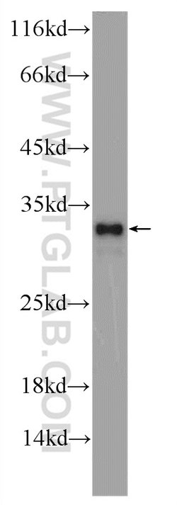 CWC15 Rabbit anti-Human, Mouse, Polyclonal, Proteintech:Antibodies:Primary