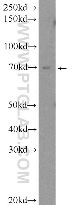 ZNF460 Rabbit anti-Human, Polyclonal, Proteintech:Antibodies:Primary Antibodies