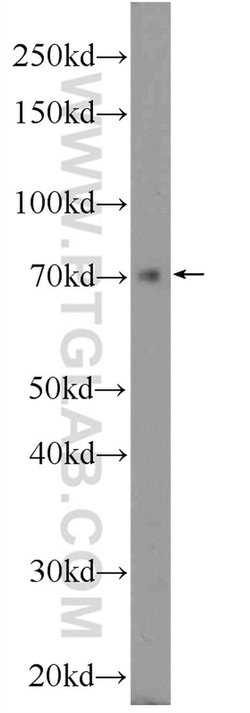 ZNF460 Rabbit anti-Human, Polyclonal, Proteintech:Antibodies:Primary Antibodies