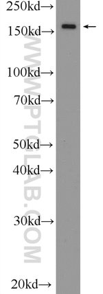 Thumbnail_EPRS Rabbit anti-Human, Polyclonal, Proteintech 20 &mu;L; Unconjugated:Antibodies,