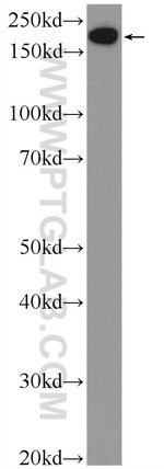 Thumbnail_EPRS Rabbit anti-Human, Polyclonal, Proteintech 20 &mu;L; Unconjugated:Antibodies,