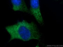 FGF17 Rabbit anti-Human, Mouse, Polyclonal, Proteintech:Antibodies:Primary