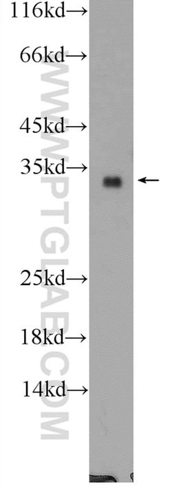 FGF17 Rabbit anti-Human, Mouse, Polyclonal, Proteintech:Antibodies:Primary