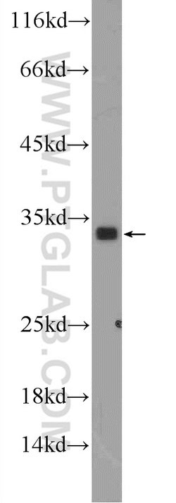 FGF17 Rabbit anti-Human, Mouse, Polyclonal, Proteintech:Antibodies:Primary