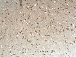 EHD3 Rabbit anti-Human, Mouse, Polyclonal, Proteintech:Antibodies:Primary