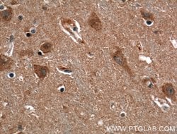 EHD3 Rabbit anti-Human, Mouse, Polyclonal, Proteintech:Antibodies:Primary