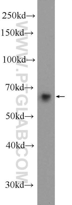 EHD3 Rabbit anti-Human, Mouse, Polyclonal, Proteintech:Antibodies:Primary
