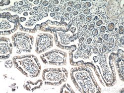 IQSEC2 Rabbit anti-Human, Polyclonal, Proteintech:Antibodies:Primary Antibodies