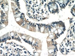 IQSEC2 Rabbit anti-Human, Polyclonal, Proteintech:Antibodies:Primary Antibodies