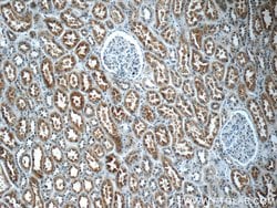 IQSEC2 Rabbit anti-Human, Polyclonal, Proteintech:Antibodies:Primary Antibodies