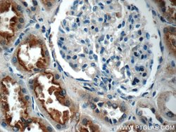 IQSEC2 Rabbit anti-Human, Polyclonal, Proteintech:Antibodies:Primary Antibodies