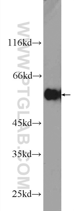 DYNC1LI1 Rabbit anti-Human, Polyclonal, Proteintech 150 &mu;L; Unconjugated:Antibodies,