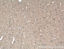 ABCA7 Rabbit anti-Human, Rat, Polyclonal, Proteintech:Antibodies:Primary