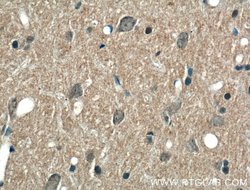 ABCA7 Rabbit anti-Human, Rat, Polyclonal, Proteintech:Antibodies:Primary