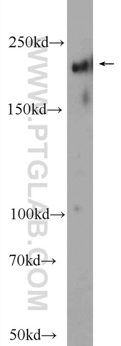 ABCA7 Rabbit anti-Human, Rat, Polyclonal, Proteintech:Antibodies:Primary