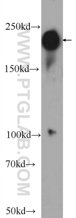 ABCA7 Rabbit anti-Human, Rat, Polyclonal, Proteintech:Antibodies:Primary