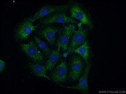 CPEB4 Rabbit anti-Human, Mouse, Rat, Polyclonal, Proteintech:Antikörper:Primärantikörper