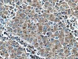 CPEB4 Rabbit anti-Human, Mouse, Rat, Polyclonal, Proteintech:Antikörper:Primärantikörper