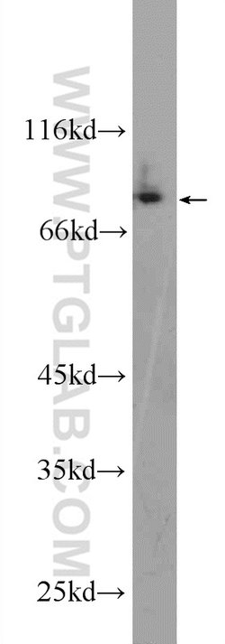 CPEB4 Rabbit anti-Human, Mouse, Rat, Polyclonal, Proteintech