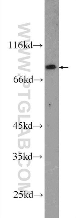 CPEB4 Rabbit anti-Human, Mouse, Rat, Polyclonal, Proteintech:Antikörper:Primärantikörper