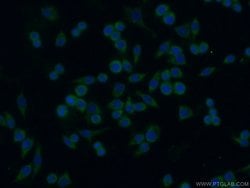 NOX5 Rabbit anti-Human, Polyclonal, Proteintech:Antibodies:Primary Antibodies
