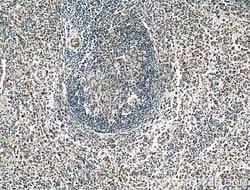 NOX5 Rabbit anti-Human, Polyclonal, Proteintech:Antibodies:Primary Antibodies