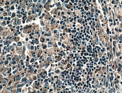 NOX5 Rabbit anti-Human, Polyclonal, Proteintech:Antibodies:Primary Antibodies