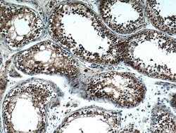 NOX5 Rabbit anti-Human, Polyclonal, Proteintech:Antibodies:Primary Antibodies