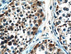 NOX5 Rabbit anti-Human, Polyclonal, Proteintech:Antibodies:Primary Antibodies