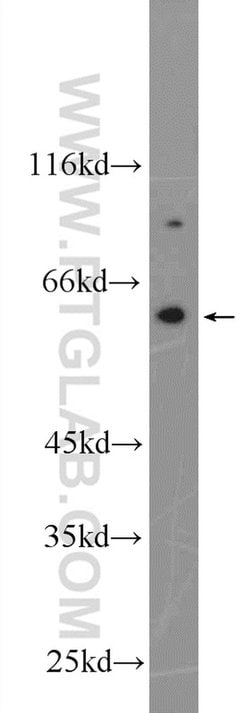 NOX5 Rabbit anti-Human, Polyclonal, Proteintech:Antibodies:Primary Antibodies