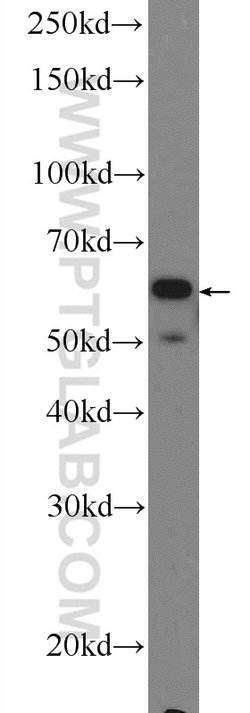 NOX5 Rabbit anti-Human, Polyclonal, Proteintech:Antibodies:Primary Antibodies