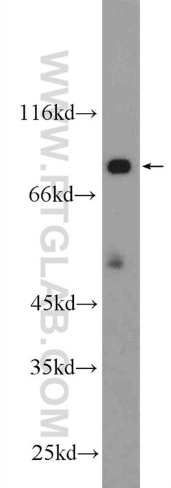 HECTD2 Rabbit anti-Human, Mouse, Polyclonal, Proteintech 150 &mu;L; Unconjugated:Antibodies,