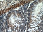 Thumbnail_HIGD1B Rabbit anti-Human, Polyclonal, Proteintech:Antibodies:Primary Antibodies
