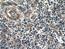 YOD1 Rabbit anti-Human, Polyclonal, Proteintech 150 &mu;L; Unconjugated:Antibodies,