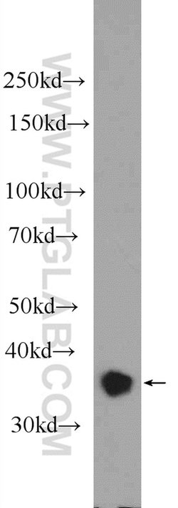 YOD1 Rabbit anti-Human, Polyclonal, Proteintech 150 &mu;L; Unconjugated:Antibodies,