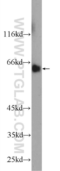 MTF1 Rabbit anti-Human, Mouse, Polyclonal, Proteintech:Anticorps:Anticorps