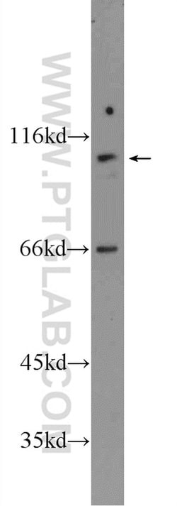 FAM160B1 Rabbit anti-Human, Polyclonal, Proteintech 150 &mu;L; Unconjugated:Antibodies,