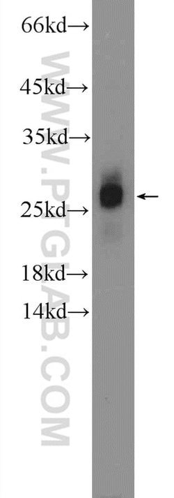 ZNF740 Rabbit anti-Human, Mouse, Polyclonal, Proteintech 150 &mu;L; Unconjugated:Antibodies,