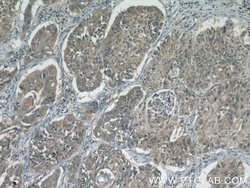 KIAA0907 Rabbit anti-Human, Mouse, Polyclonal, Proteintech 20 &mu;L | Buy Online | Proteintech | Fisher Scientific