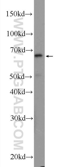 KIAA0907 Rabbit anti-Human, Mouse, Polyclonal, Proteintech 20 &mu;L | Buy Online | Proteintech | Fisher Scientific